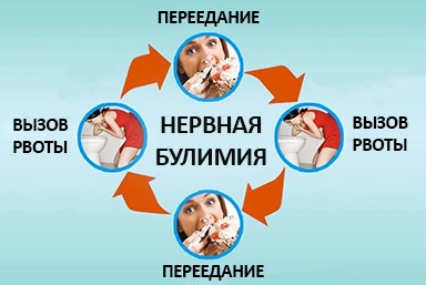 Лечение булимии в Ярцево